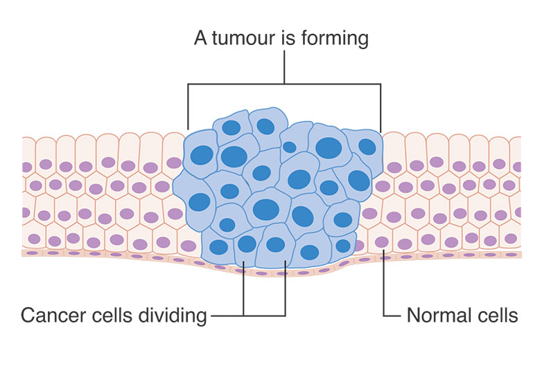 Cancer-cells-reproducing